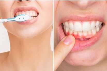 Lý do bạn nên giữ bàn chải đánh răng ở góc 45 độ so với nướu